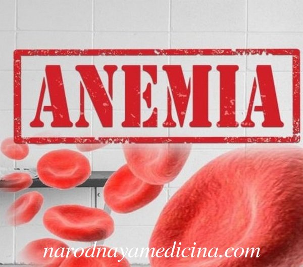 Анемія – що це таке, і чим небезпечна. Залізодефіцитна анемія – симптоми і лікування