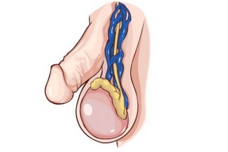 Біль в мошонці у чоловіків – всі причини з фото і лікування