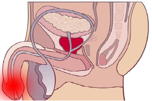 Біль в мошонці у чоловіків – всі причини з фото і лікування