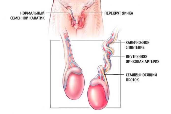 Чому болить член і що робити в цій ситуації