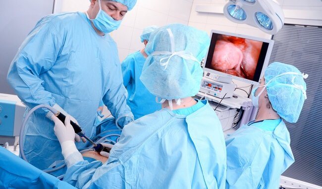 Лапароскопія – в чому перевага операції і як вона проводиться