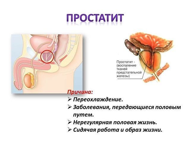 Простанорм – інструкція по застосуванню та відгуки