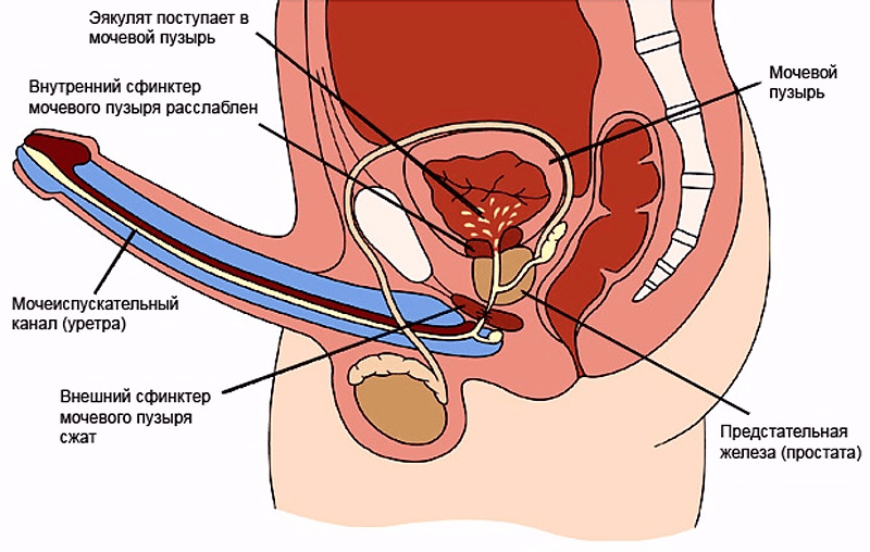 Ретроградна еякуляція: причини, симптоми, лікування