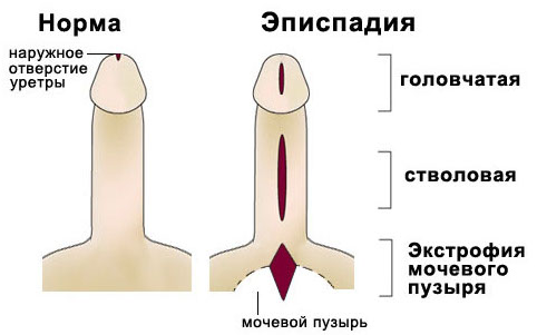 Що лікує уролог: види урологічних проблем і план їх лікування