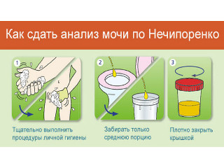 Сеча за Нечипоренком: як здавати і підготуватися до аналізу дорослому