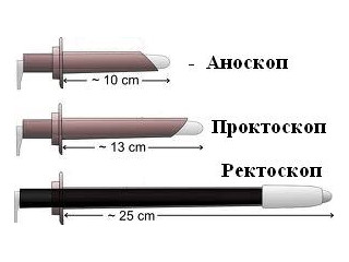 Симптоми геморою, класифікація і особливості захворювання