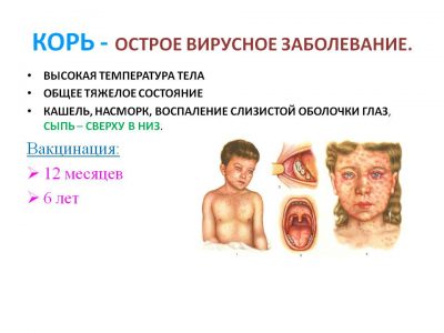 Висип на тілі дитини: причини і лікування