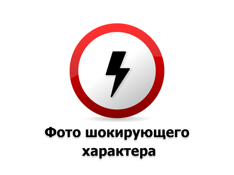 Водянка яєчка, або гідроцеле: що це за хвороба і у кого вона буває