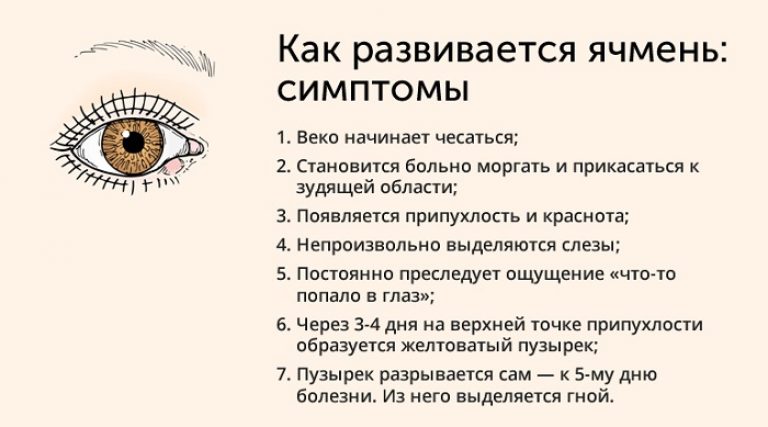 Як запобігти ячмінь на оці на ранній стадії