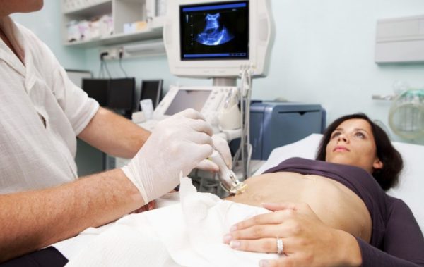 11 причин папілом в жовчному міхурі — як від них позбутися?