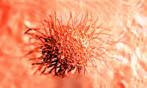 3 етапи зараження вірусом папіломи людини 18 типу