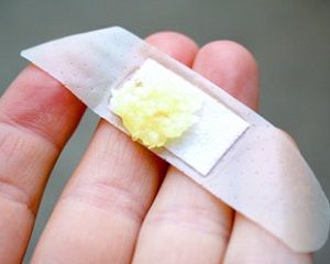 4 причини бородавки на ногах — кошти та мазі для лікування