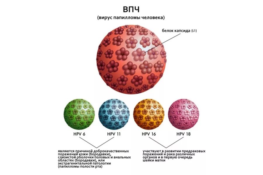 5 методів лікування і видалення папілом на обличчі, які наслідки?
