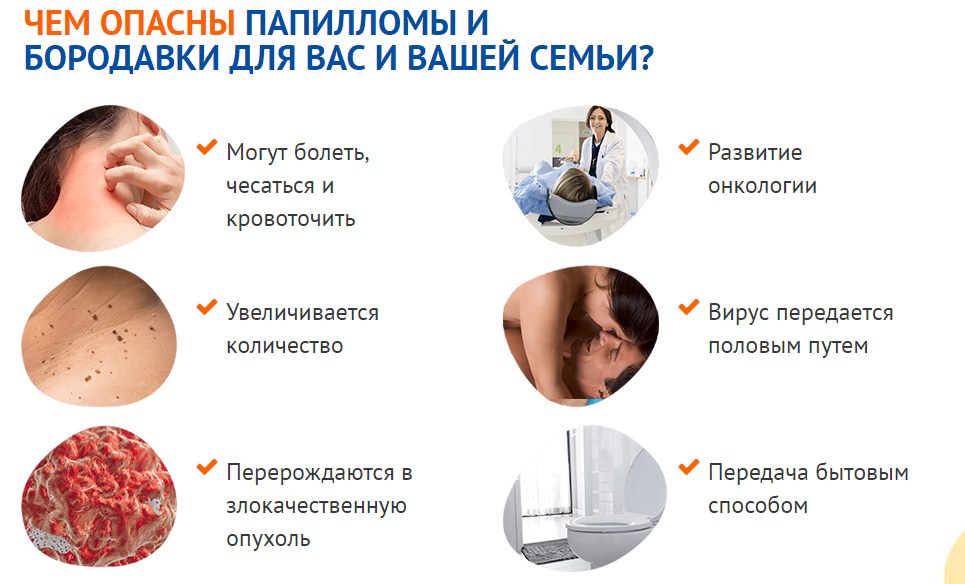 5 передумов до інфікування ВПЛ, як передається?
