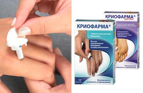 5 переваг і недоліків криофармы від папілом
