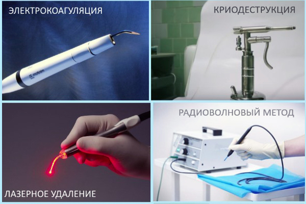 5 причин зміни кольору папілом, що робити якщо болить або засохла