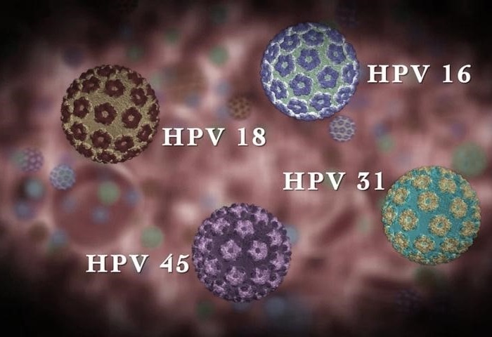 5 відмінних особливостей ВПЛ 16 типу від інших типом вірусу папіломи