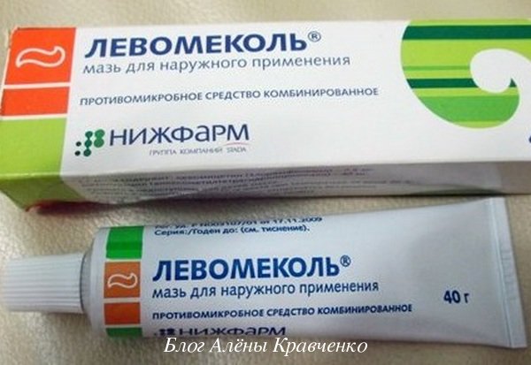 Болячки під носом у дитини. 26 коштів – чим мазати болячку під носом