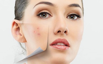 Бородавки на губах, носі, в роті — як відбувається зараження?