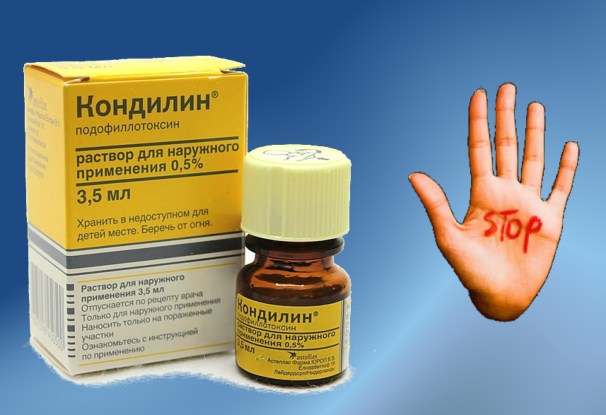 чи Можна позбутися від папілом будинку, не відвідуючи лікаря, методи