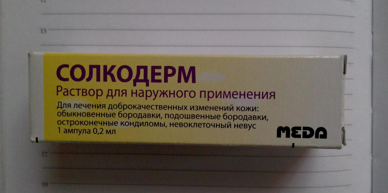 Кондиломи — показання до видалення, як правильно від них позбутися, щоб не нашкодити?