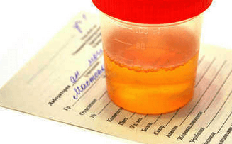 Кров у сечі у жінок – список можливих патологій