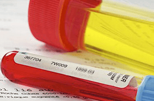 Кров у сечі у жінок – список можливих патологій