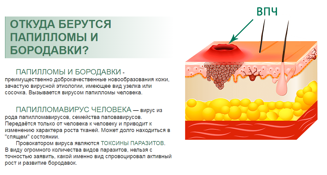 Можна проводити лікування впл народними засобами. 7 методів