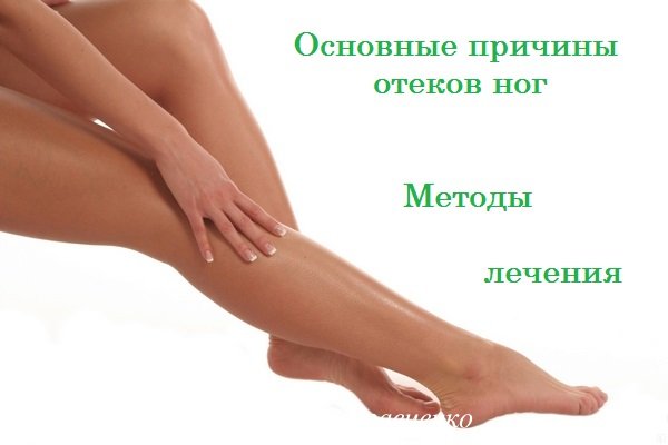 Набрякають ноги в щиколотках у жінок. Причини, симптоми, лікування