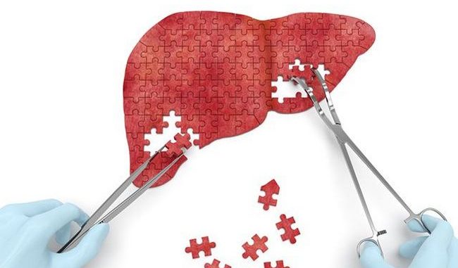 Наскільки страшний жировий гепатоз печінки і як його лікувати?