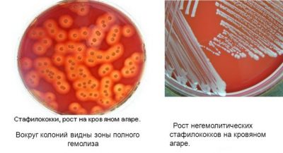 Пиодермит: симптоми, причини виникнення та способи лікування