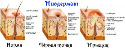 Пиодермит: симптоми, причини виникнення та способи лікування