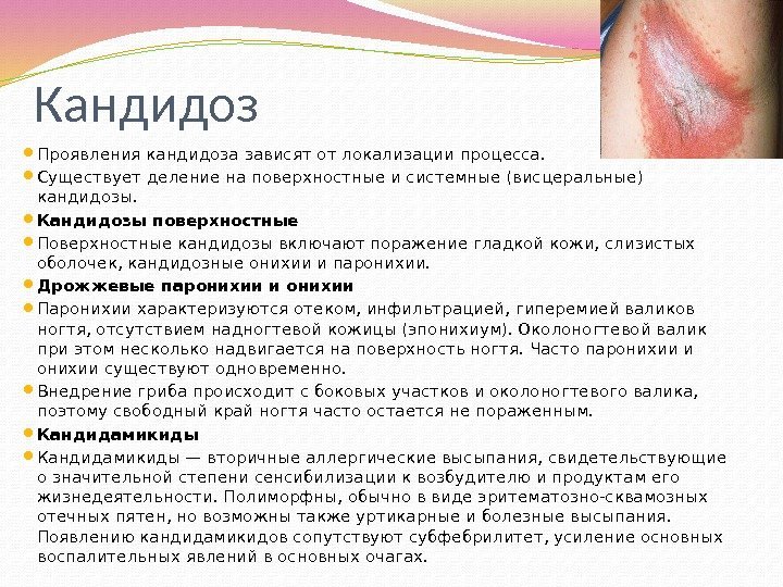 Популярні питання про кондиломах