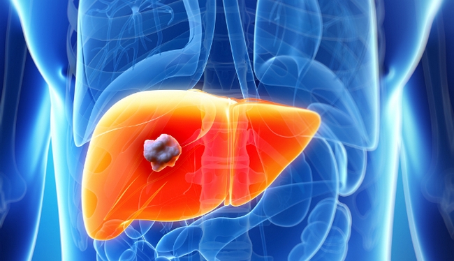 Причини, симптоми гепатомегалії та способи боротьби з нею