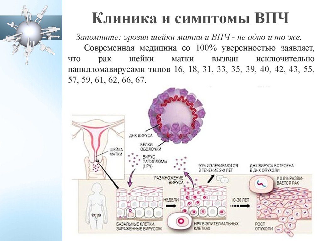 Що таке вірус папіломи 39 типу і як його лікувати?