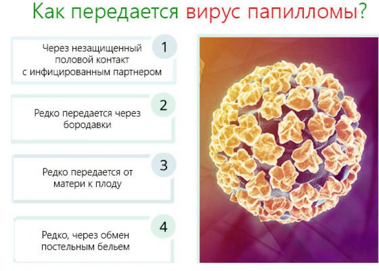 Що таке вірус папіломи 39 типу і як його лікувати?