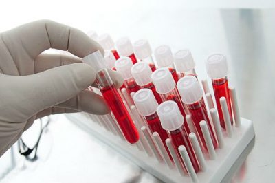 Симптоми, лікування та можливі наслідки поясывающего позбавляючи