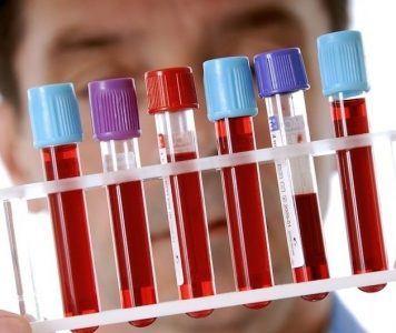 Стрептодермія: як розпізнати і вилікувати хворобу?