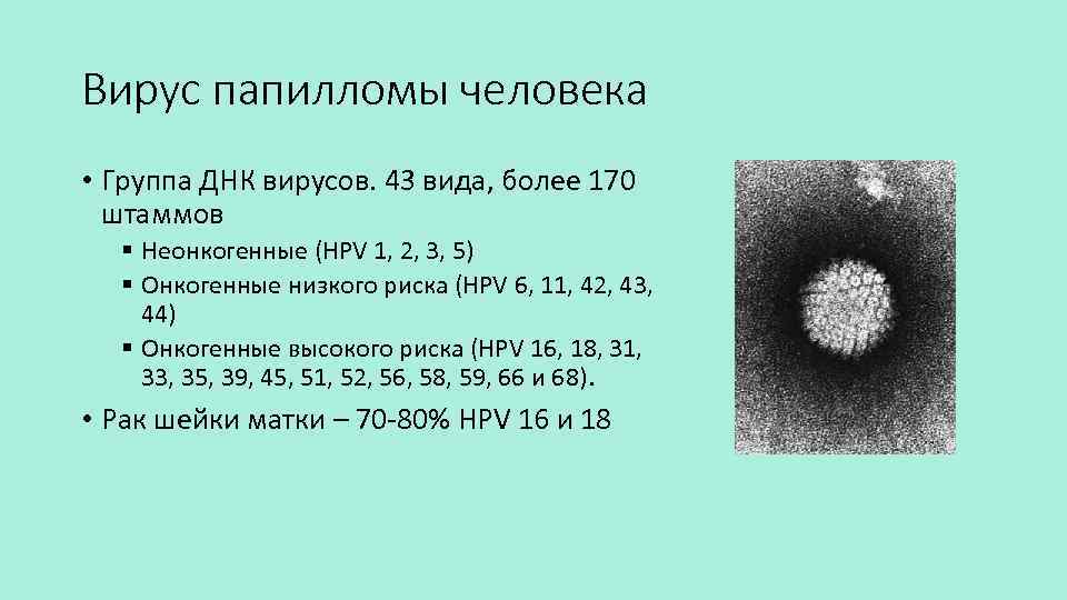 Вірус папіломи людини 33 типу — що це таке, ознаки та діагностика
