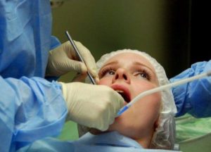 Впл на яснах, язику, піднебінні та інших місцях у роті, причини появи і лікування
