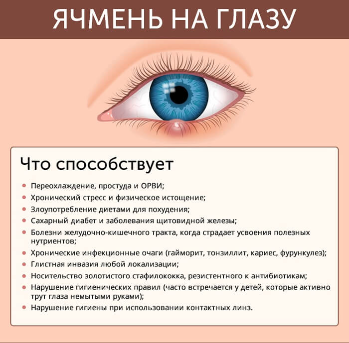 Ячмінь всередині ока