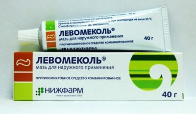 Як ефективно лікувати чиряк в домашніх умовах?
