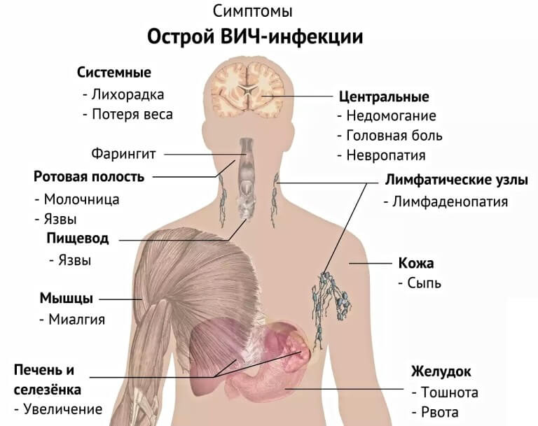 Як проявляється ВІЛ у чоловіків – перші симптоми і аналізи