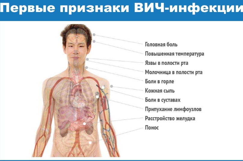 Як проявляється ВІЛ у чоловіків – перші симптоми і аналізи