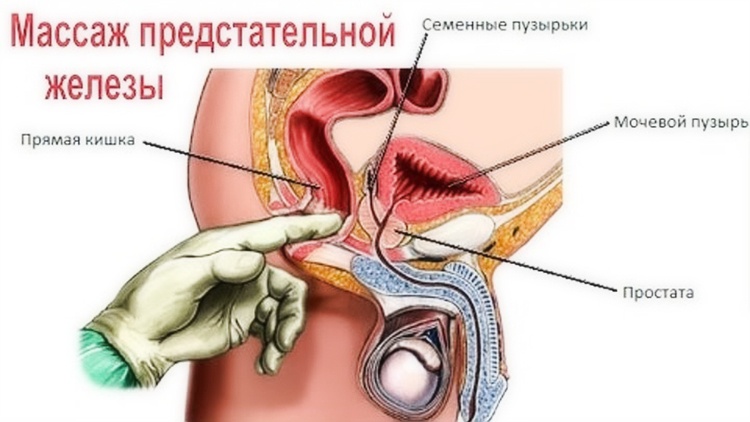 Як робити масаж простати чоловікові в домашніх умовах