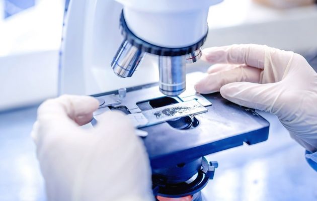 Як зробити скринінг вірусу папіломи людини, особливості аналізу